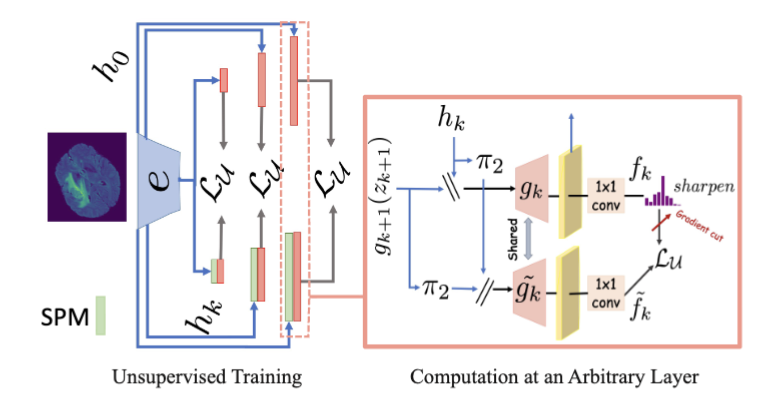 [Preprint] A MuST for Consistency Regularization in Semi-Supervised Medical Image Segmentation